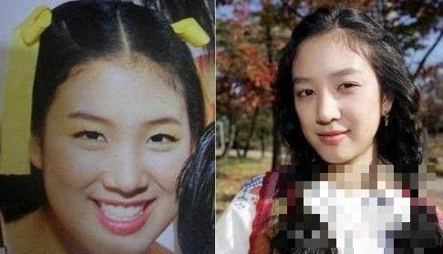 韩国女星整容排行榜 颜值变化太夸张 第一名直接年轻了20岁
