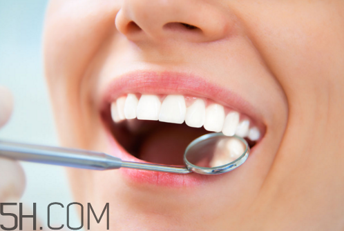 >洗牙后牙缝变大是怎么回事？怎么保持牙齿洁白？