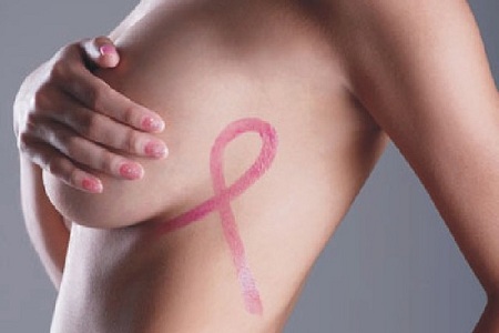 每周运动75分钟降低乳癌风险