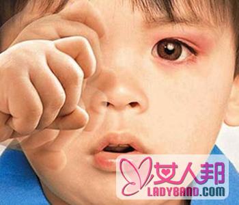 >【红眼病症状】红眼病传染吗_红眼病怎么治疗最快_怎么预防患红眼病_宝宝眼睛红是患了红眼病吗