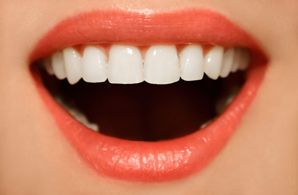牙结石图片_牙结石怎么去除_牙结石的危害推荐分类