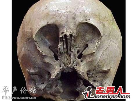 墨西哥发现一怪异头骨 疑是外星人和地球人混血