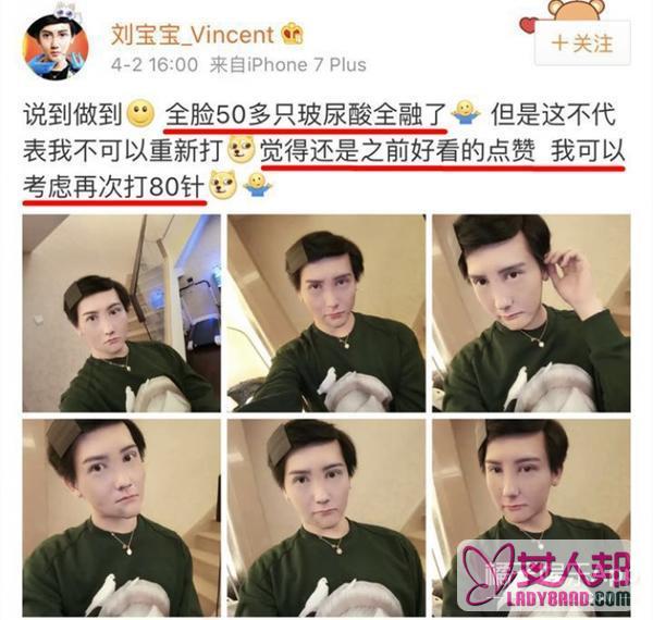 刘梓晨融掉全脸50多支玻尿酸，网友纷纷跪求请再打回去！