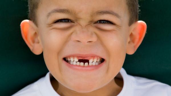 儿童从什么时候开始换牙,顺序是怎样的