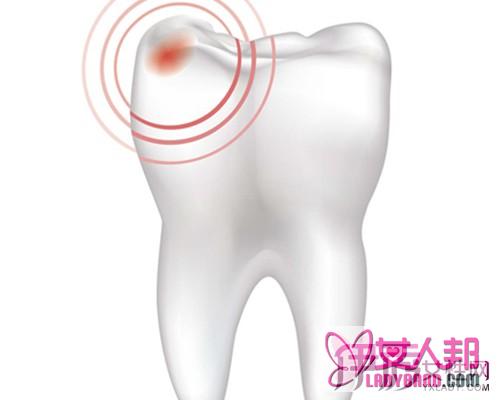 >牙痛吃什么药最管用 教你4种方法止牙痛