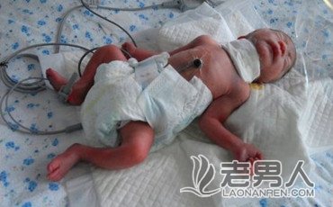 出生20天的男宝宝遭割喉，疑生母下毒手