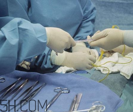 包茎手术可以用医保吗？包茎手术能报销吗？