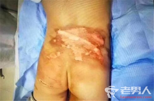 云南两名小学生遭校园暴力 被5名同学脱裤子用开水烫（图）