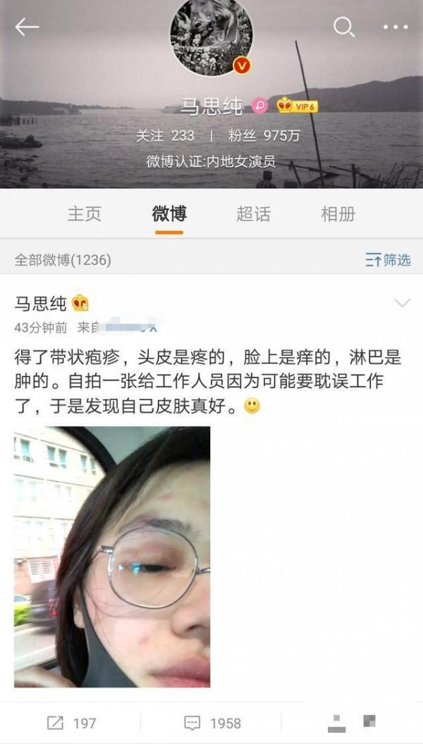 >马思纯患带状疱疹眼皮发红还拍照自黑 马思纯为什么得带状疱疹?