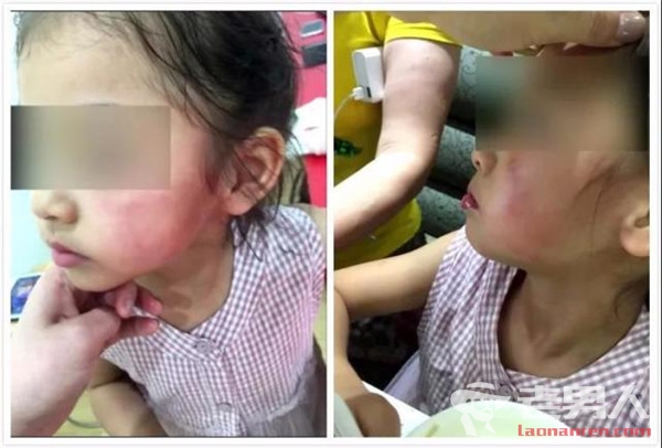 4岁女孩因争玩具被对方妈妈掌掴 视频曝光网友怒了