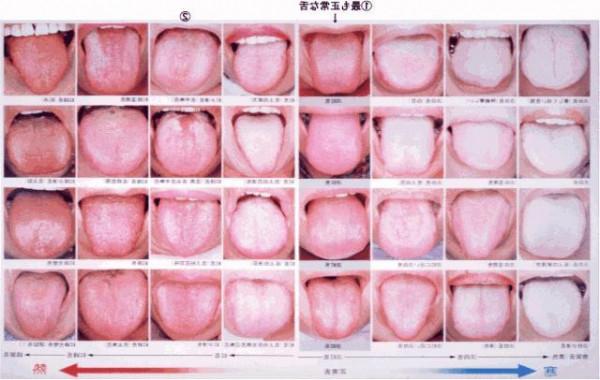 罗大伦舌诊 20140723x诊所2014全集:罗大伦讲舌诊看健康