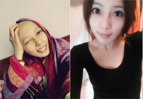 梦想秀李娜去世直播 19岁“最美癌症女孩”离世 高陵姑娘李娜曾上《中国梦想秀》