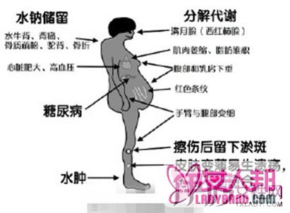 >疾病糖皮质激素的副作用 六大点警醒用药需谨慎