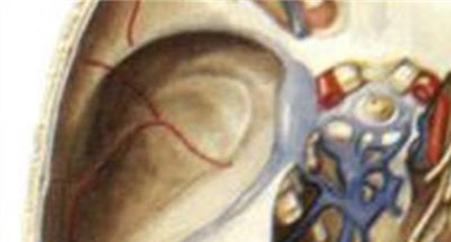 硬脑膜窦名词解释 硬脑膜动静脉瘘的手术原则
